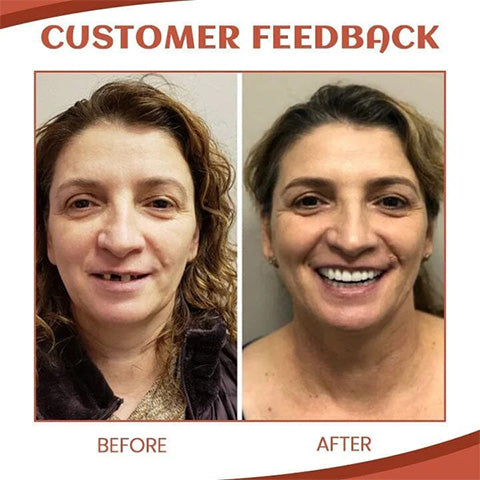 SecureSmile™ | Experience pain-free security with dentures all day long