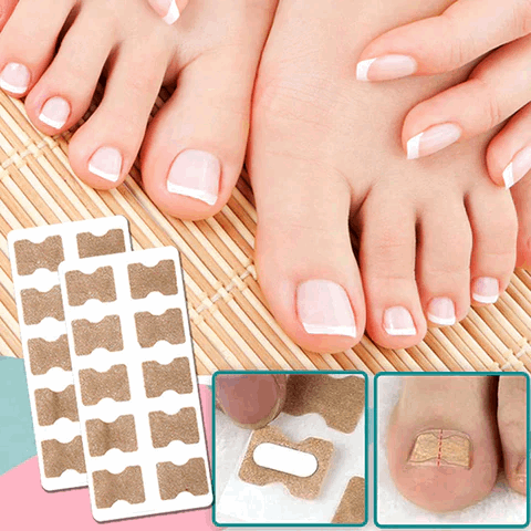 50% Discount |  FinePatches™ | Correction Patches for Beautiful and Healthy Nails