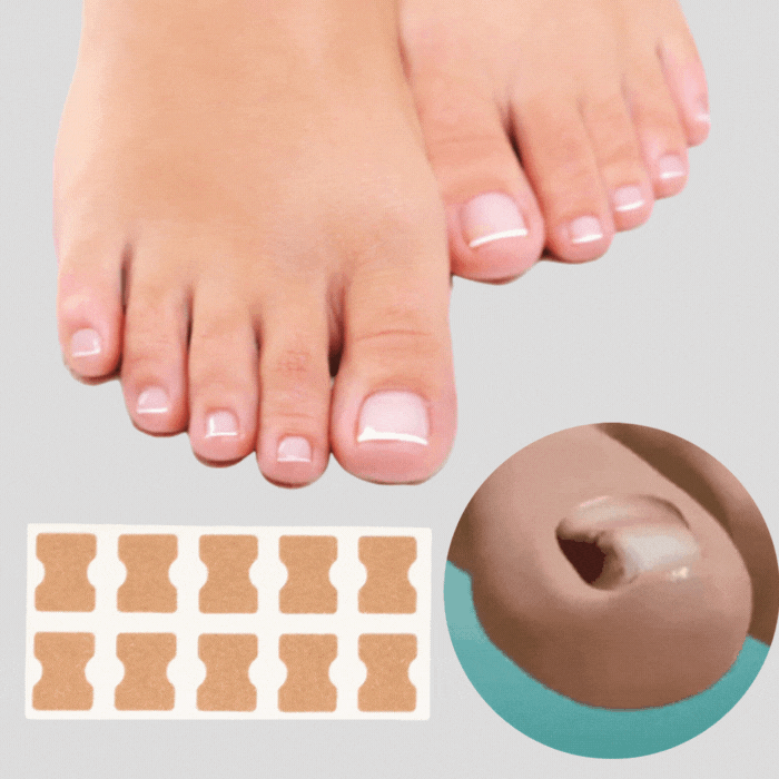 50% Discount |  FinePatches™ | Correction Patches for Beautiful and Healthy Nails