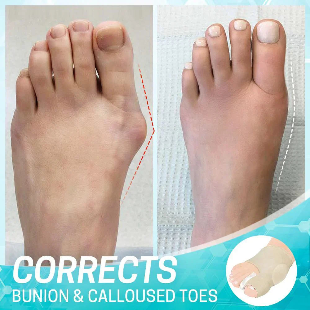 1+1 Free | ComfortToe™ | Painless yet effective solution