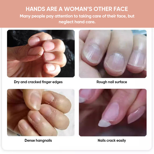 VitalNails™ | Revive Damaged Nails