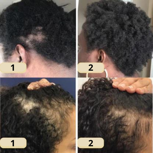 HairElixir™ | Hair Growth Oil
