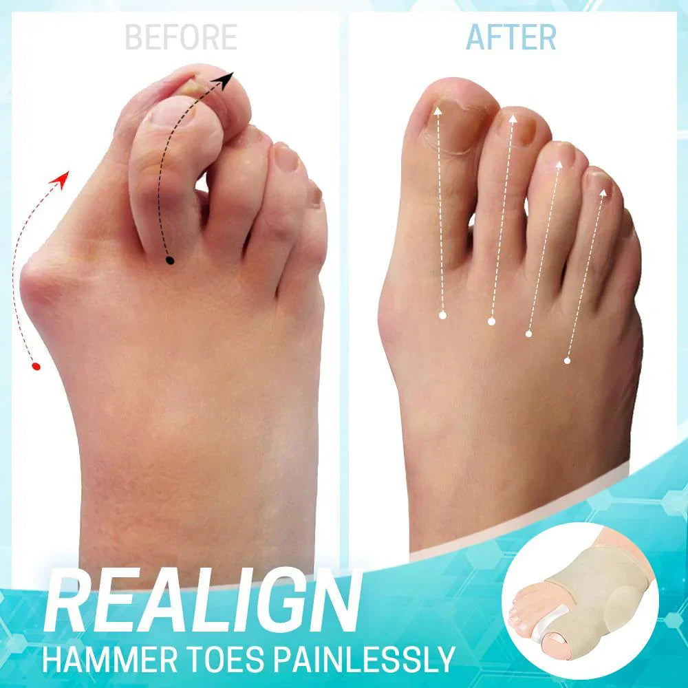 1+1 Free | ComfortToe™ | Painless yet effective solution