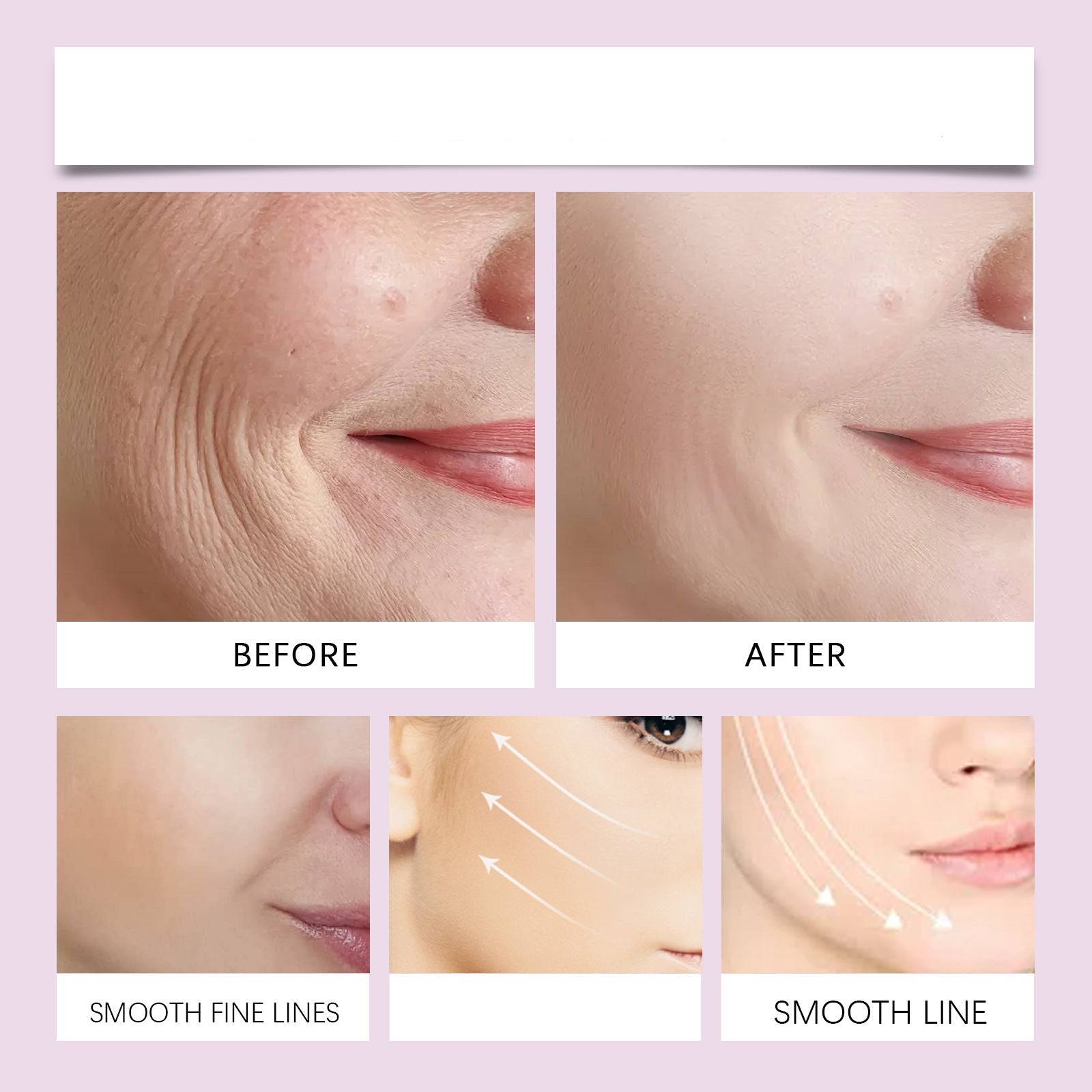 LuxLift™ | Lift your chin and radiate youthfulness without surgery!