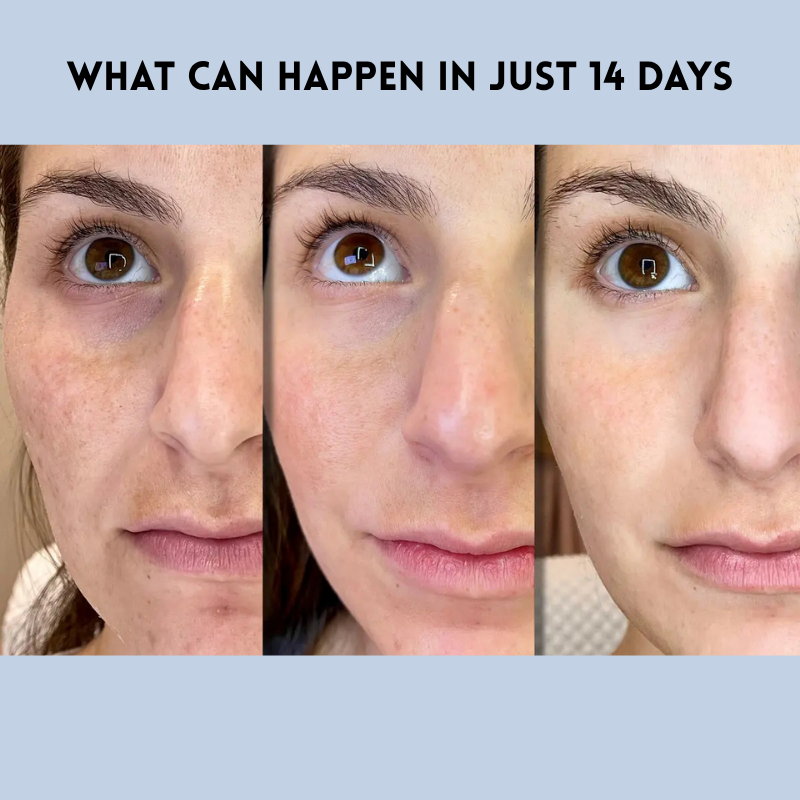 FirmPatch™ | Secure without wrinkles