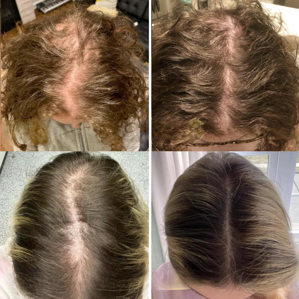 HairElixir™ | Hair Growth Oil