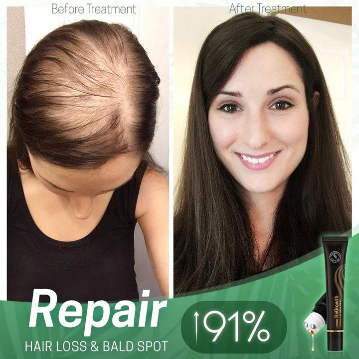 1+1 FREE | NextGrow™ | Revive your hair with remarkable shine and strength