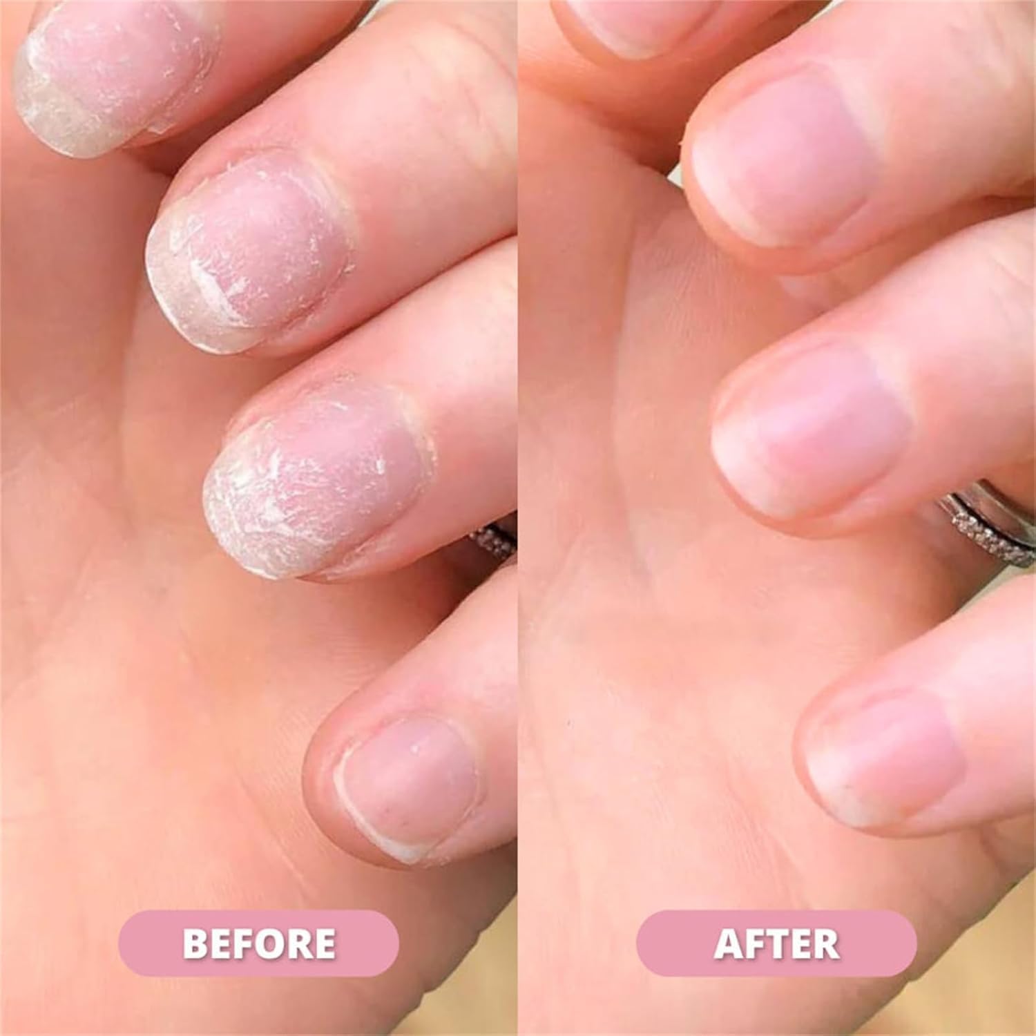 VitalNails™ | Revive Damaged Nails