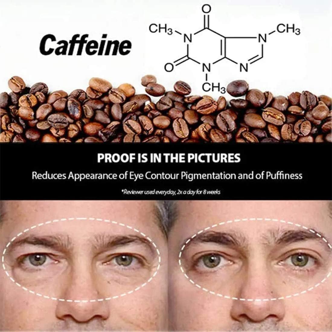 50% discount | EyeRenew™ | Radiant & youthful fresh eye renewal