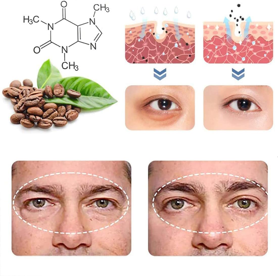 50% discount | EyeRenew™ | Radiant & youthful fresh eye renewal