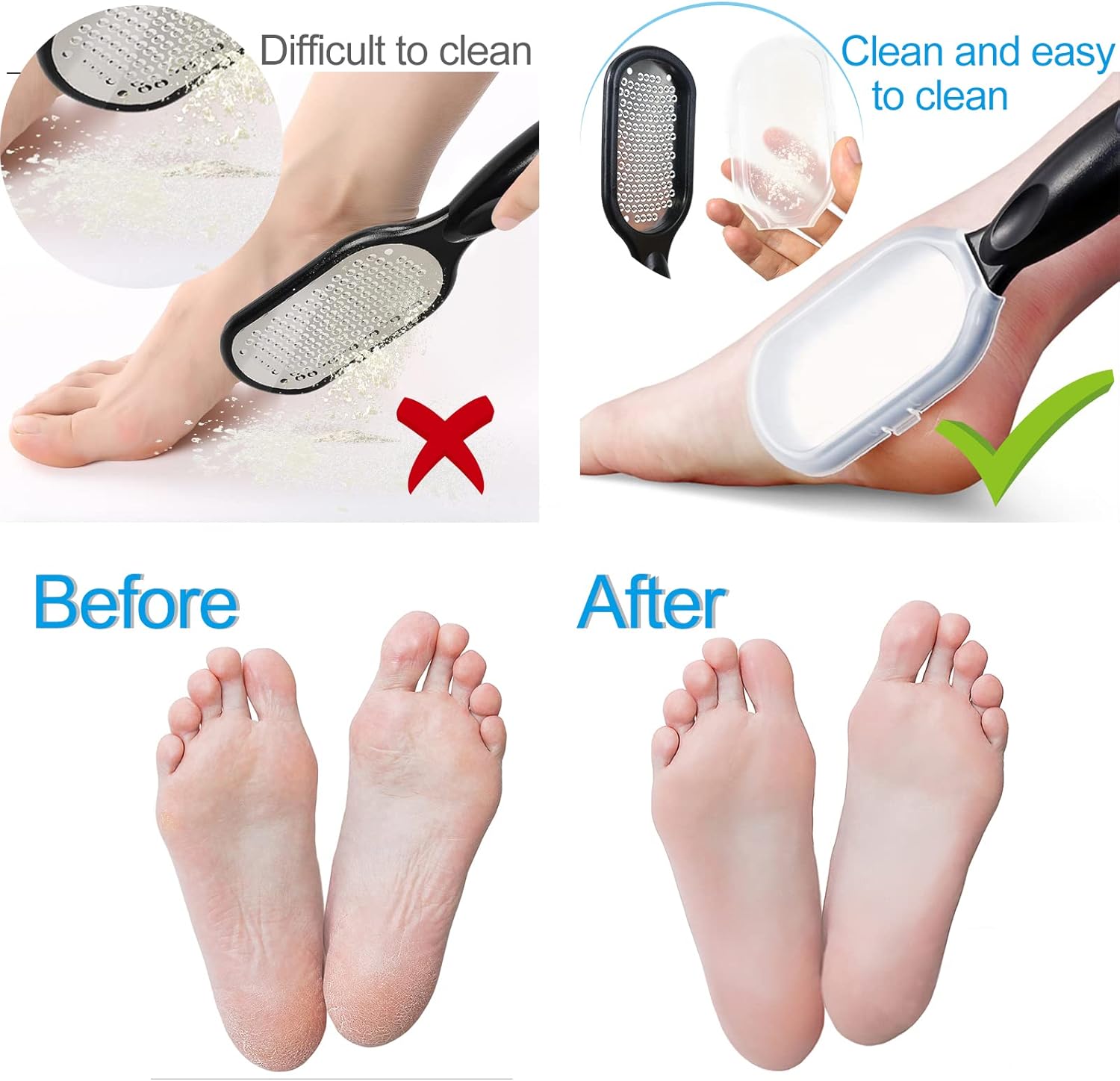 1+1 FREE | SaniSleek™ | For Soft Feet in Minutes