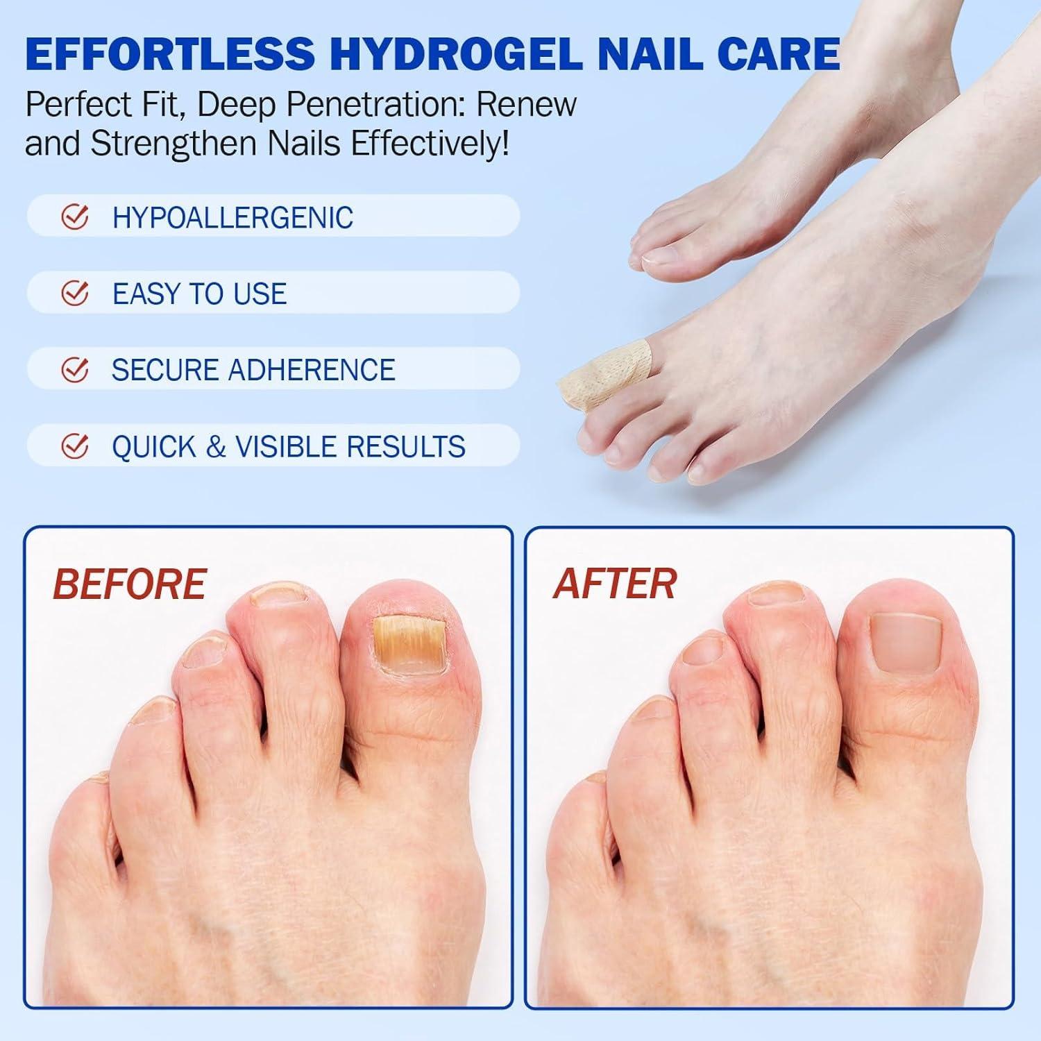 PureNail™ | Optimal restoration of your nails
