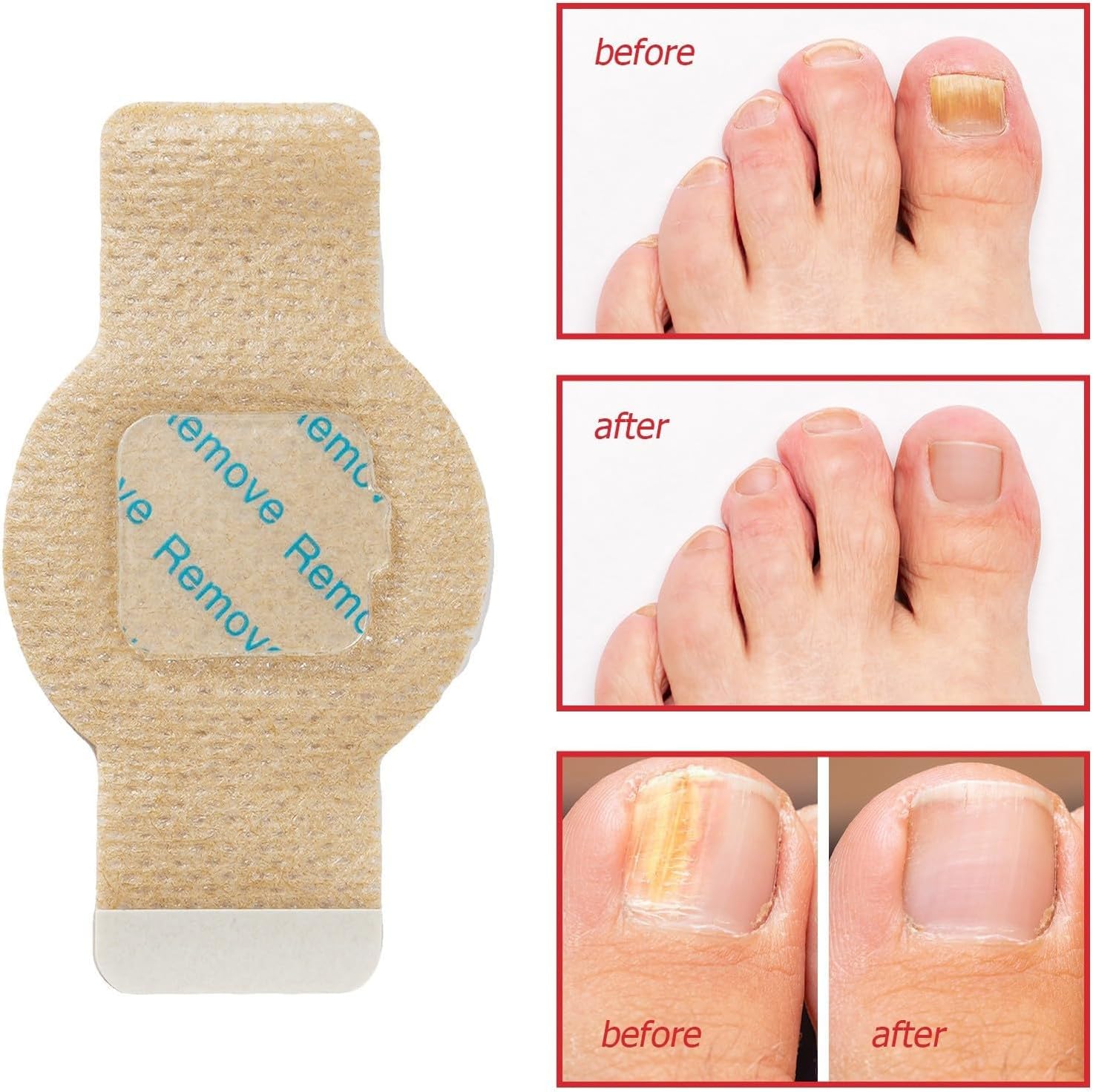 PureNail™ | Optimal restoration of your nails