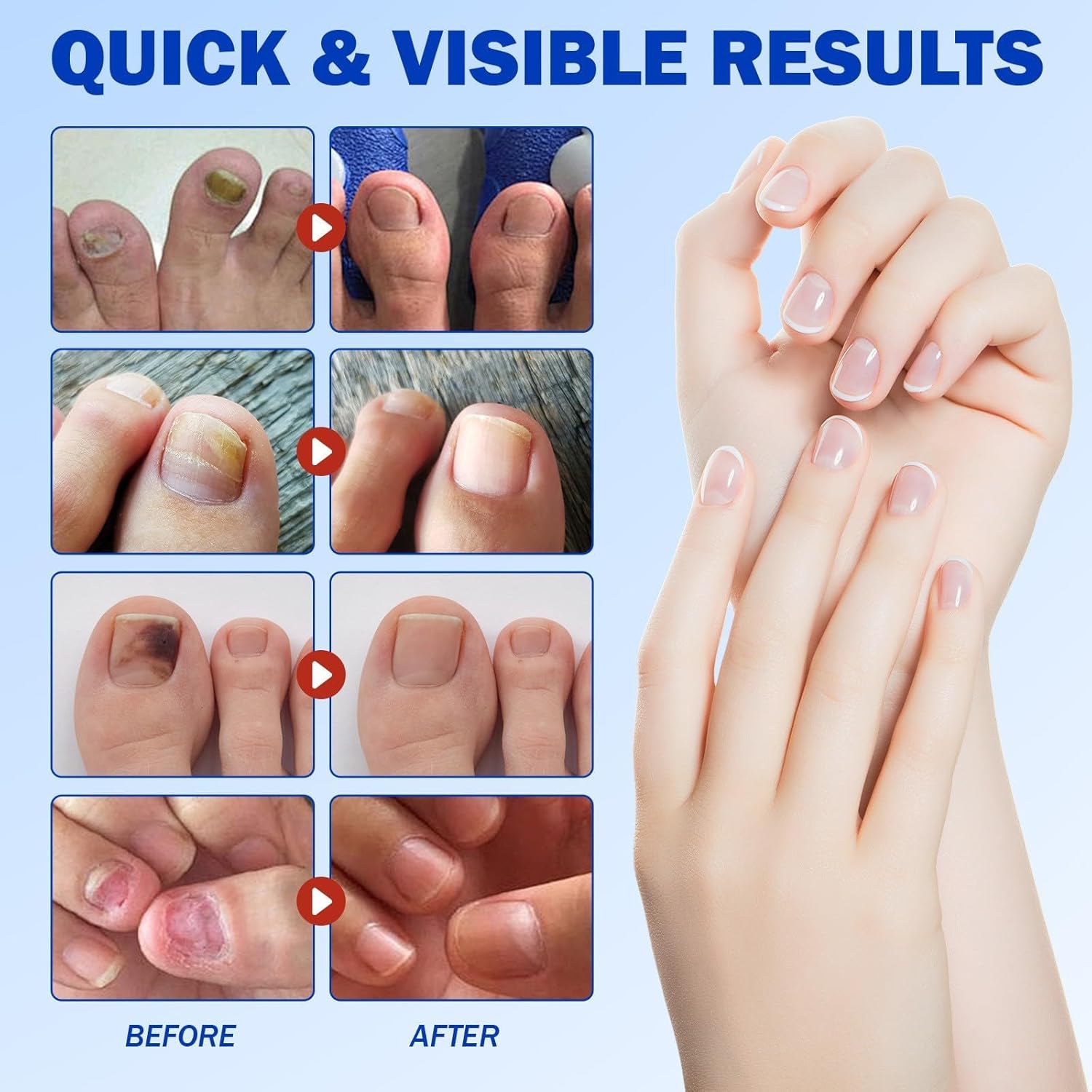 PureNail™ | Optimal restoration of your nails