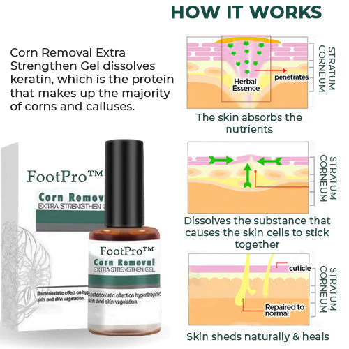 FootPro™ | Corn Removal Gel – Painless, fast, and effective gel for gentle foot care and callus removal
