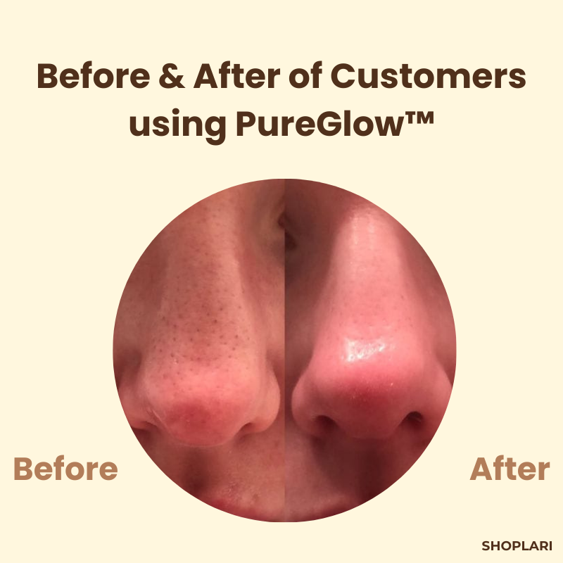 RadianceRush™ | Black Tea Power Mask — Clear, radiant skin that magically attracts everyone's attention! (2 pieces)