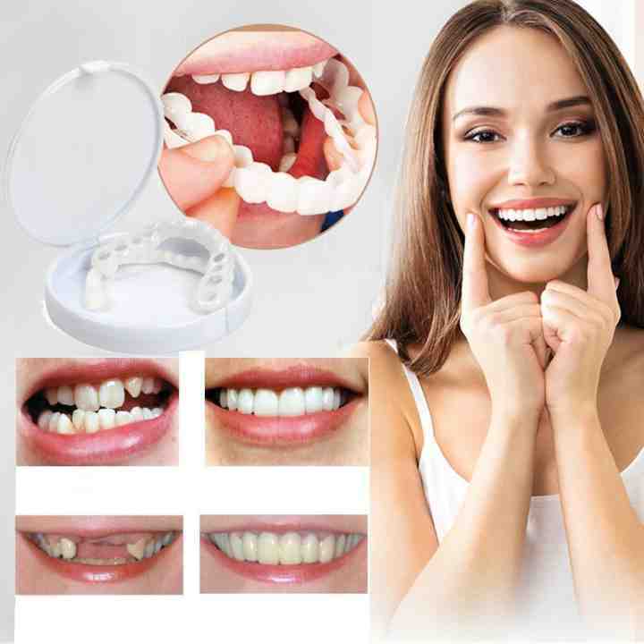 SnapSmile | Snap-On Dentures