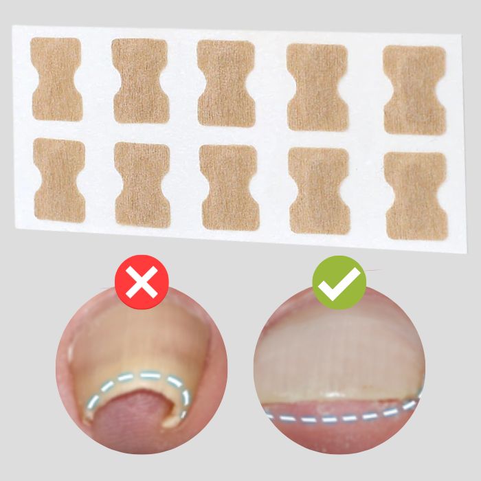 50% Discount |  FinePatches™ | Correction Patches for Beautiful and Healthy Nails
