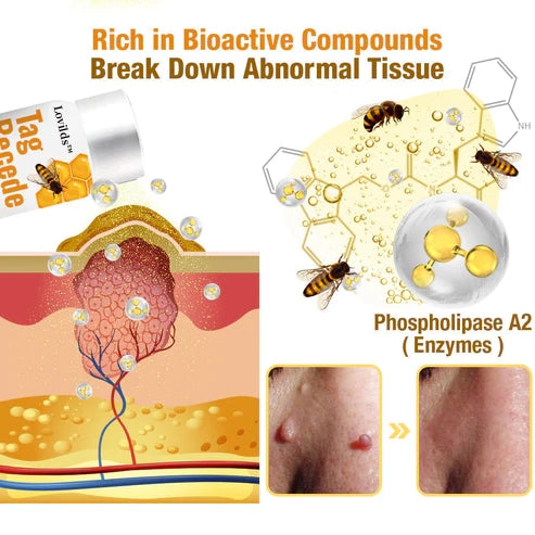 TagAway | Effective removal of warts and skin growths