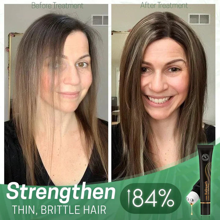 1+1 FREE | NextGrow™ | Revive your hair with remarkable shine and strength