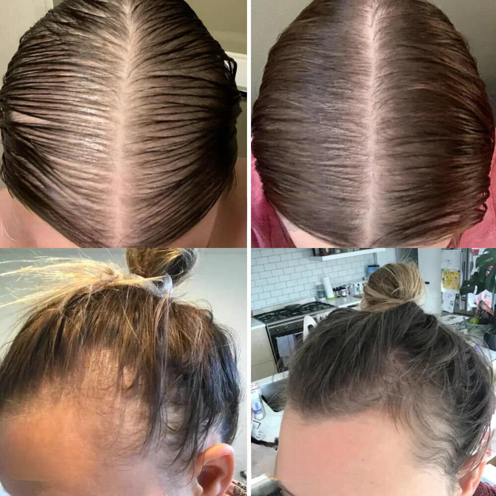 HairElixir™ | Hair Growth Oil
