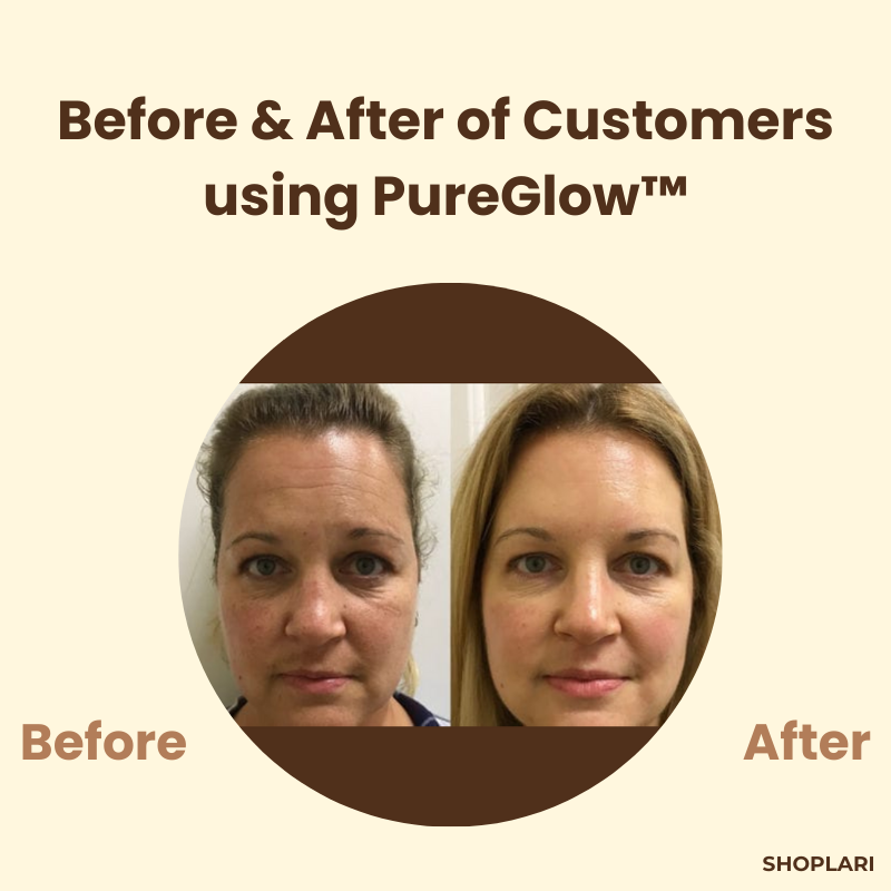 RadianceRush™ | Black Tea Power Mask — Clear, radiant skin that magically attracts everyone's attention! (2 pieces)