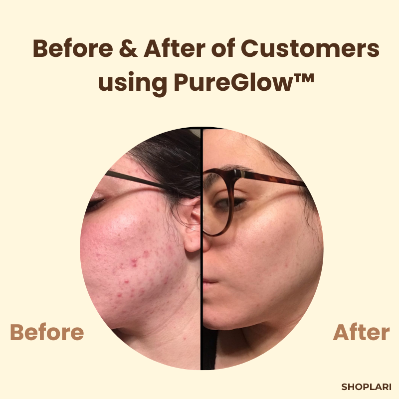 RadianceRush™ | Black Tea Power Mask — Clear, radiant skin that magically attracts everyone's attention! (2 pieces)